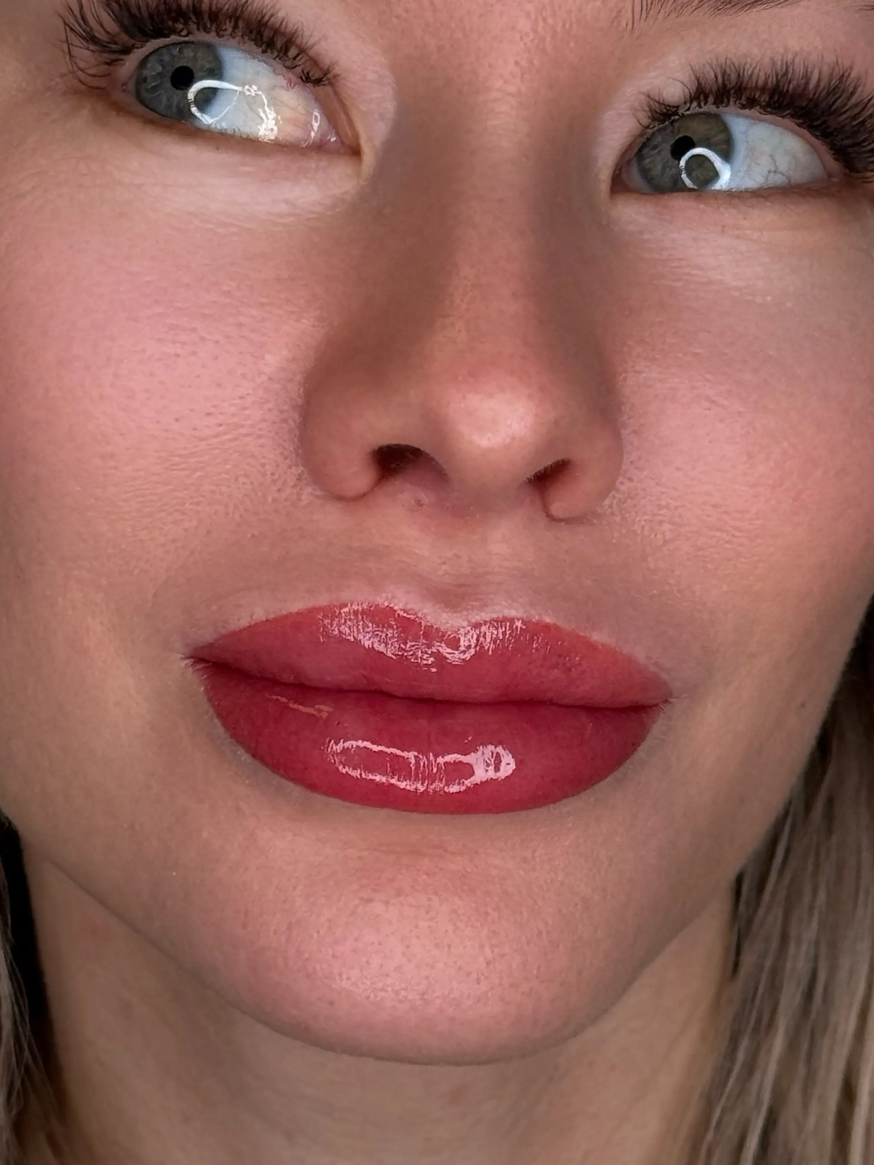 Vorher Lippen