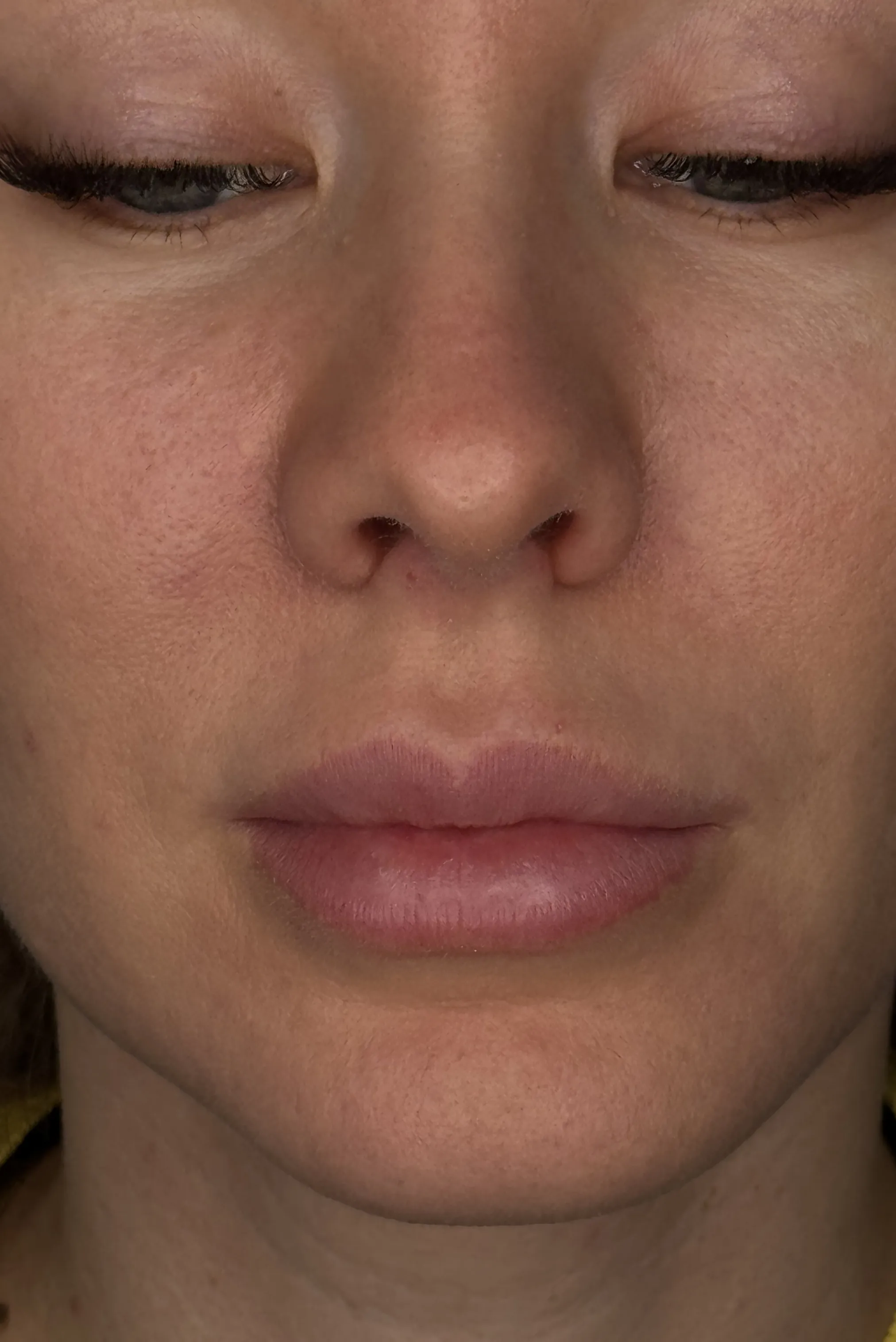 Lip Blush Vorher